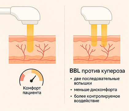 В чём отличие от классического IPL