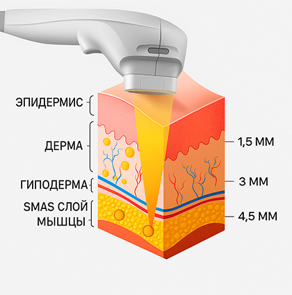 Осложнения